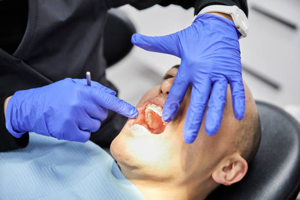 Best Emergency Dentist for Lost Fillings or Crowns in Bren Bow, OK