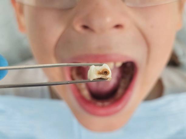 Best Holiday Emergency Dentist in Bren Bow, OK