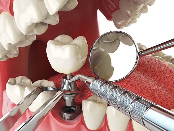 Best Orthodontic Emergency Dentist in Bren Bow, OK